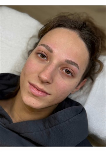 Brow Lifting: Der strahlende Moment für Kundinnen