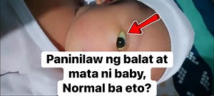 483K views · 617 reactions | Parenting Guide‼️Paninilaw ng Mata at...