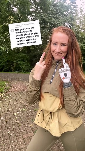 Exploring Robotic Prosthetics and Artistic Expression