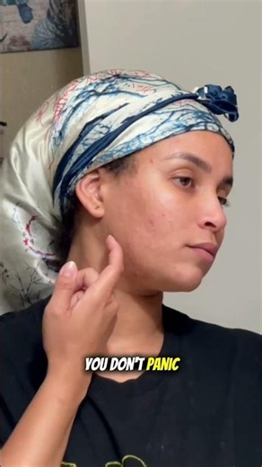 ecurring Boils & Cysts? That Relief Feeling Is Everything 😭