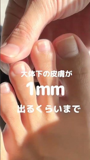 #巻き爪#巻き爪ケア#爪切りの正しい切り方#フットケア