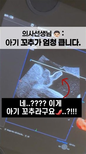 Doctor: "The baby's penis is huge."