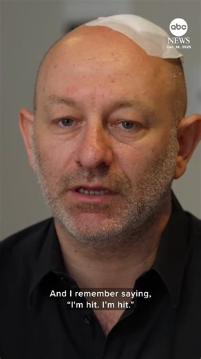 "It was millimeters between life and death." A survivor who was shot in the head in the Bondi Beach attack tells ABC News' Britt Clennett that what he chooses to take out of the tragedy "is not the barbarism of the attackers, but the humanity shown by everyone else." https://abcnews.visitlink.me/OYAgDP | ABC News