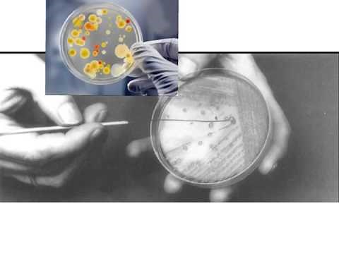 how to streak a bacterial agar plate