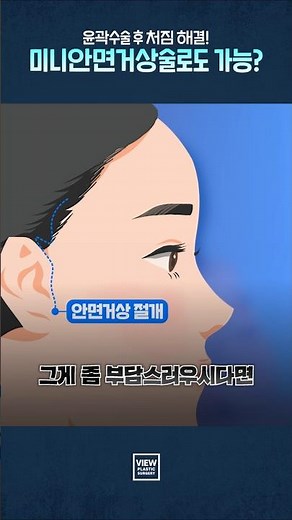 [안면거상] 거상은 무섭고, 처짐은 싫다면? 'OO 리프팅'이 정답! 🏥