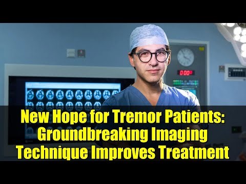 New Hope for Tremor Patients: Groundbreaking Imaging Technique Improves Treatment