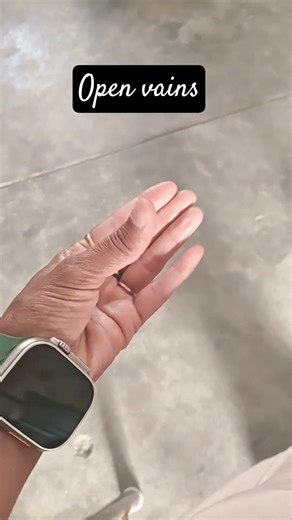 Open vains without pain, #ॐ नमः शिवायः, जय बाबा की #shortsfeed