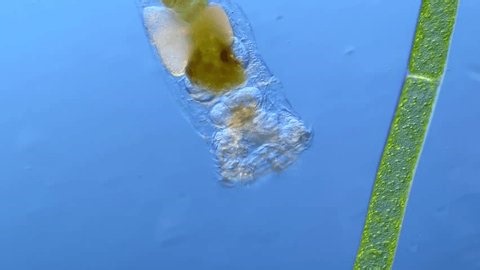 clip-3998869327-epiphanes-rotifer-under-microscope-100x-magnification