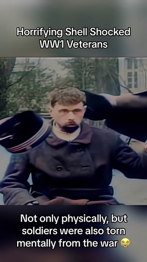 WW1 Shell Shock | #historytok #history #fyp #viral #historical #ww1 #war #old #footage #sad #shellshock