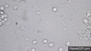 I'm sick. Here is my mucus under the microscope. on Make a GIF