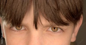 Close-up of a teenager boy blinking eyes. He blinks frequently, tired eyes freckles on the skin Brown hair, brown eyes man. Generative AI
