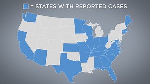 'Super lice' now found in 25 states