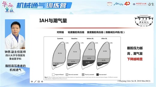 腹腔高压患者的机械通气 钟西