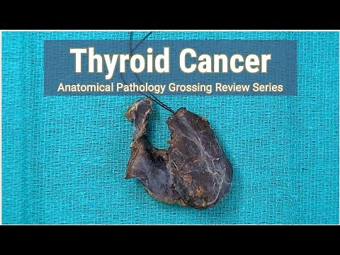 Thyroid Cancer + Neck Dissection | Anatomical Pathology Grossing Review Series