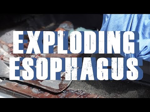 S2 Episode 8: Exploding Esophagus
