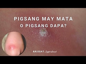 Pigsang may mata o Pigsang dapa?