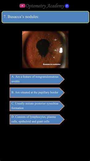 Optometry Academy on Reels