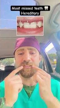 Your Teeth Ghosted You?! 👻 The Missing Tooth Mystery Explained!