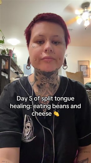 Split Tongue Healing: Enjoying Soft Foods Again