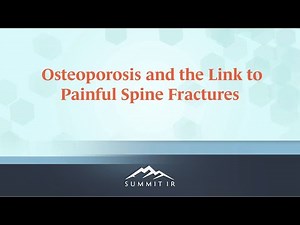 Compression Fracture of the Spine - Causes and Treatments