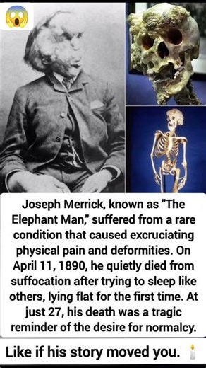 lThe Tragic, Quiet Death of Joseph Merrick: A Desire for Normalcy #viral #history #trending