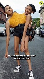 1.3M views · 9.3K reactions | Most Unusual Twins That Actually Exist #short #reels #knowledge #education #reels #viralfacts | Untold Facts | Facebook
