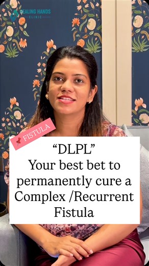 A Complex or Recurrent Fistula is extremely difficult to treat. Conventional methods have upto 60-70% success rate. Chances of Complications & Recurrence with these methods is this quite high. That is where Dr Ashwin Porwal’s DLPL stands out. It’s an excellent choice for treating these complicated fistulas. There is no risk of incontinence as sphincter muscle is preserved. Success rate is >98%. Follow-up care is extremely thorough. This leaves no chance for recurrence. So, if you or someone clos