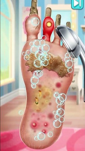 ASMR Game 🤢 These Feet Haven’t Been Cleaned in YEARS… So Satisfying!”