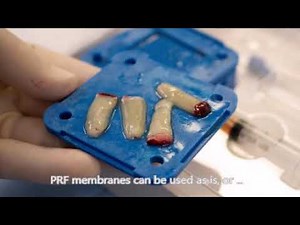 Rebound PRF Kit Instructional Video