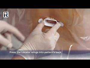 How to Mark the Skin with the Accuro Locator Needle Guide [3 Steps]