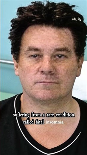 The Man Who Didn’t Sleep for 6 Months: The Case of Michael Corke #truestory