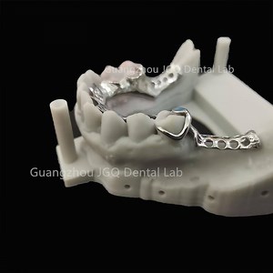 [Hot Item] Customized Metal Framework Make of Cobalt-Chromium Alloy or Pure Titanium with High Strength Support Acrylic Dentures