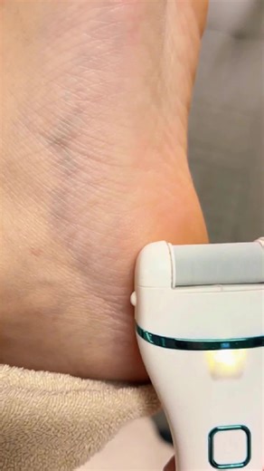 Electric Foot File for Smooth Feet Care