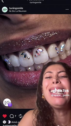 Strass Dentaire : Formation et Techniques Essentielles