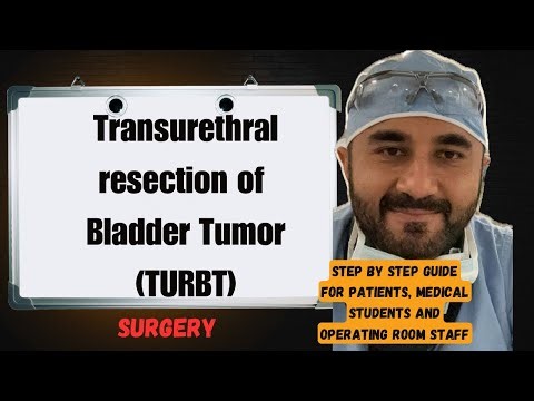 What to Expect for transurethral resection of bladder tumor TURBT Surgery 😳(Step by step guide) 👀 ❤️