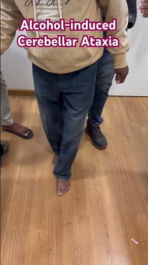 Alcohol-related Cerebellar Ataxia