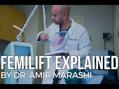 FemiLift Explained by Dr. Amir Marashi | Vaginal Rejuvenation