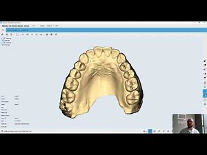 7- LIVE Focus on Maestro 3D ortho design software