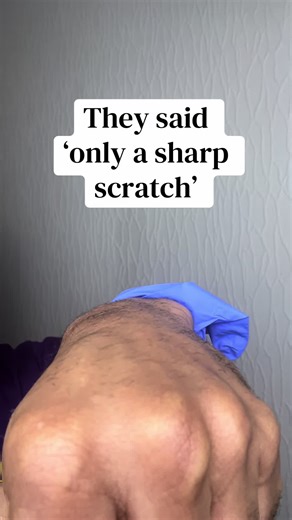 POV: The Struggles of Failed Cannulation in Nursing