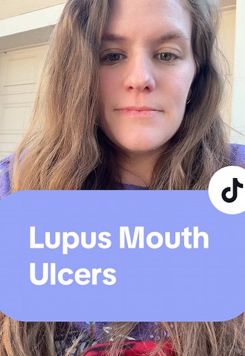 Understanding Lupus and Sjogren's Mouth Ulcers