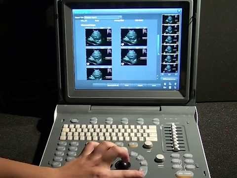CHISON ECO1 Ultrasound | Operation: How to use, scan, save report, print, and DICOM
