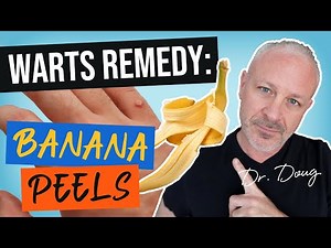 Warts Remedy: Banana Peels! | Dr. Doug