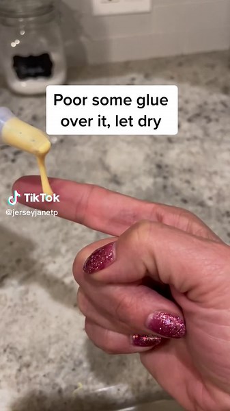 Easy Splinter Removal Hacks for Pain-Free Results