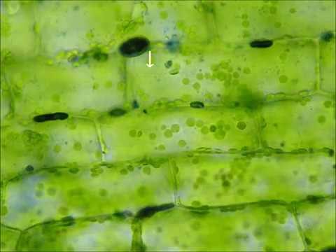 オオカナダモの葉の細胞ヤヌスグリーン染色