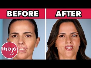 Top 10 Unbelievable Transformations on Botched