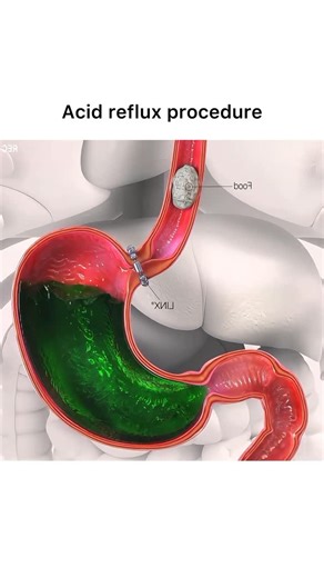 Animations on Instagram: "Follow @surgicalanimation for more! 🏥"
