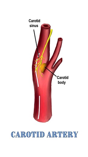 Carotid body Vs Carotid sinus. Chemoreceptors Vs Baroreceptors.