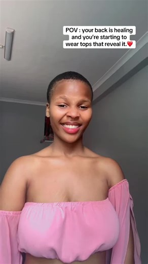 Effective Solutions for Back Acne Treatment