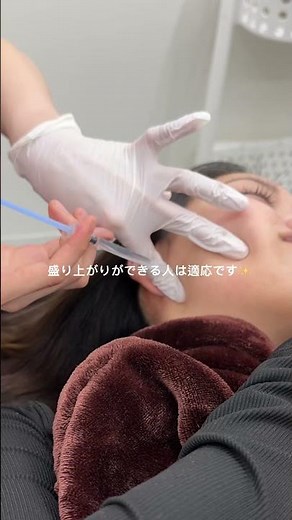 ボトックス注射について💉💞