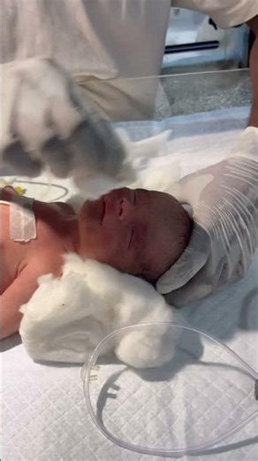 Newborn baby cleaning face🥲👍 #youtubeshorts #nursing #newbornbaby #cleaning #face #sacribe #viral